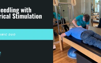 Enhancing Healing: The Dynamic Duo of Dry Needling with Electrical Stimulation